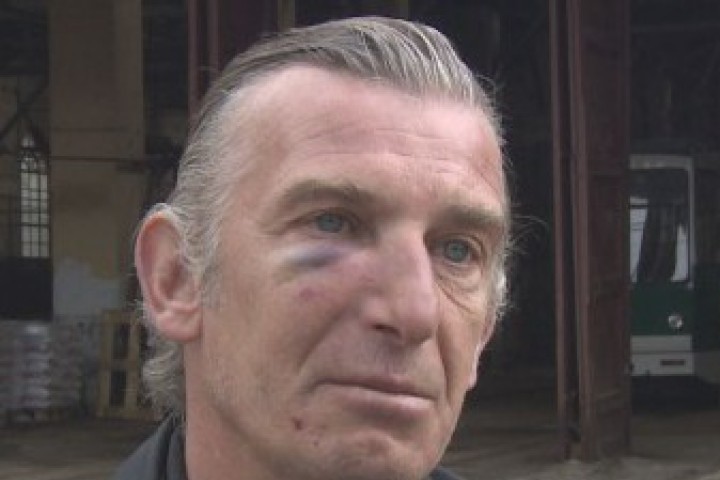 Шокиращото в случая че мъжът е нападнат от три момичета