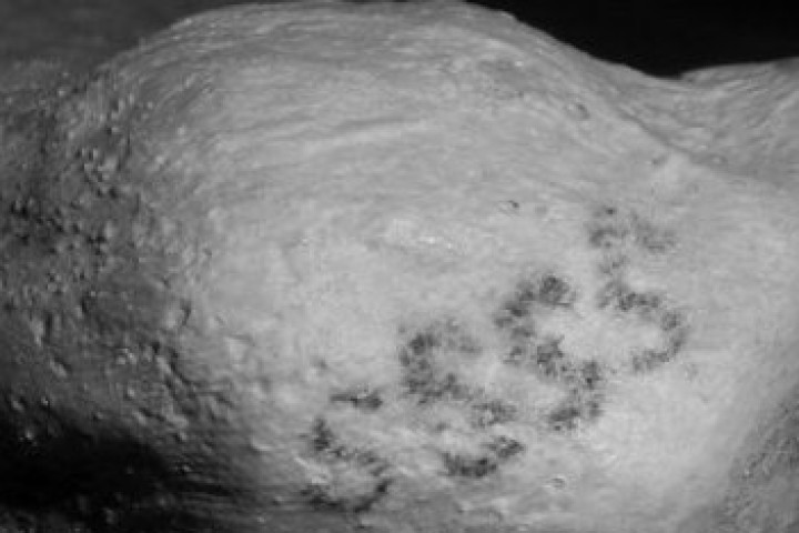 Татуировките на горната част на ръката на мъжката мумия изобразяват